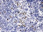 MMP9 Polyclonal Antibody