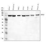MSH2 Antibody in Western Blot (WB)