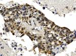 MTA1 Polyclonal Antibody