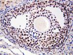 MTA1 Antibody in Immunohistochemistry (Paraffin) (IHC (P))