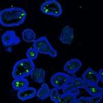 MUC2 Antibody in Immunohistochemistry (Paraffin) (IHC (P))