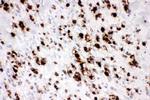 MUC5AC Polyclonal Antibody