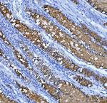 MUC5AC Polyclonal Antibody