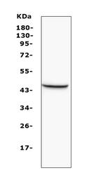 MVD Polyclonal Antibody