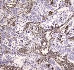 MVP Antibody in Immunohistochemistry (Paraffin) (IHC (P))