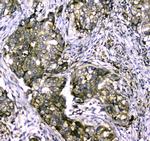 MYBPC3 Polyclonal Antibody