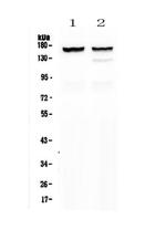 MYBPC3 Antibody in Western Blot (WB)