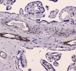 MYLK Antibody in Immunohistochemistry (Paraffin) (IHC (P))