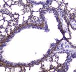 MYLK Antibody in Immunohistochemistry (Paraffin) (IHC (P))