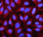 NDUFA1 Polyclonal Antibody