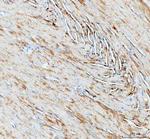NDUFA1 Antibody in Immunohistochemistry (Paraffin) (IHC (P))