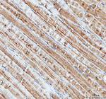 NDUFA1 Antibody in Immunohistochemistry (Paraffin) (IHC (P))