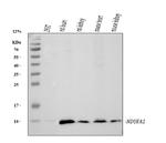 NDUFA1 Antibody in Western Blot (WB)