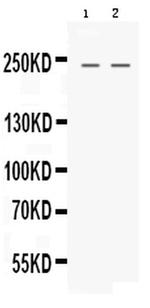 Nestin Antibody in Western Blot (WB)