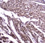 NFIB Antibody in Immunohistochemistry (Paraffin) (IHC (P))