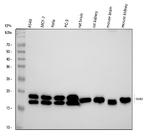 NME1 Antibody in Western Blot (WB)