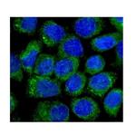 NOV Polyclonal Antibody