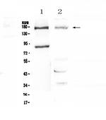 NPC1 Polyclonal Antibody