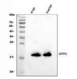 ANP Antibody in Western Blot (WB)