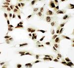 NRF1 Polyclonal Antibody