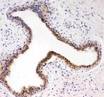 TrkC Polyclonal Antibody