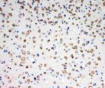 TrkC Antibody in Immunohistochemistry (Paraffin) (IHC (P))