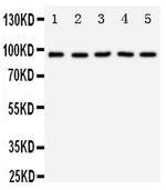 TrkC Antibody in Western Blot (WB)