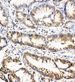 Oncostatin M Polyclonal Antibody
