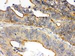 Oncostatin M Polyclonal Antibody