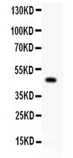 P2X5 Antibody in Western Blot (WB)
