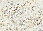 PDCD4 Antibody in Immunohistochemistry (Paraffin) (IHC (P))