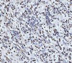 PDCD4 Polyclonal Antibody