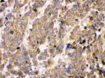 PDPK1 Polyclonal Antibody