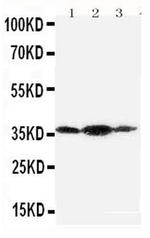 Podoplanin Antibody in Western Blot (WB)