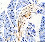 CD31 (PECAM-1) Antibody in Immunohistochemistry (Paraffin) (IHC (P))