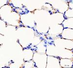 PF4 Polyclonal Antibody