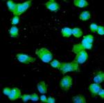 Profilin 2 Polyclonal Antibody