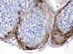 PI3 Antibody in Immunohistochemistry (Paraffin) (IHC (P))