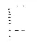 PLAC9 Polyclonal Antibody