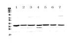 uPAR (CD87) Polyclonal Antibody