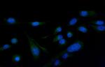 PLCG2 Polyclonal Antibody