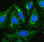 Plectin Polyclonal Antibody