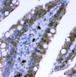 Plectin Antibody in Immunohistochemistry (Paraffin) (IHC (P))