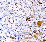 Plectin Antibody in Immunohistochemistry (Paraffin) (IHC (P))
