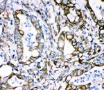 Plectin Antibody in Immunohistochemistry (Paraffin) (IHC (P))