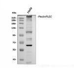 Plectin Antibody in Western Blot (WB)