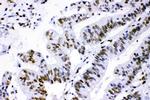 PML Antibody in Immunohistochemistry (Paraffin) (IHC (P))