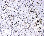 PML Antibody in Immunohistochemistry (Paraffin) (IHC (P))
