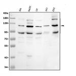 PML Antibody in Western Blot (WB)