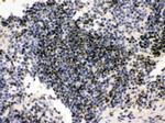 PML Polyclonal Antibody